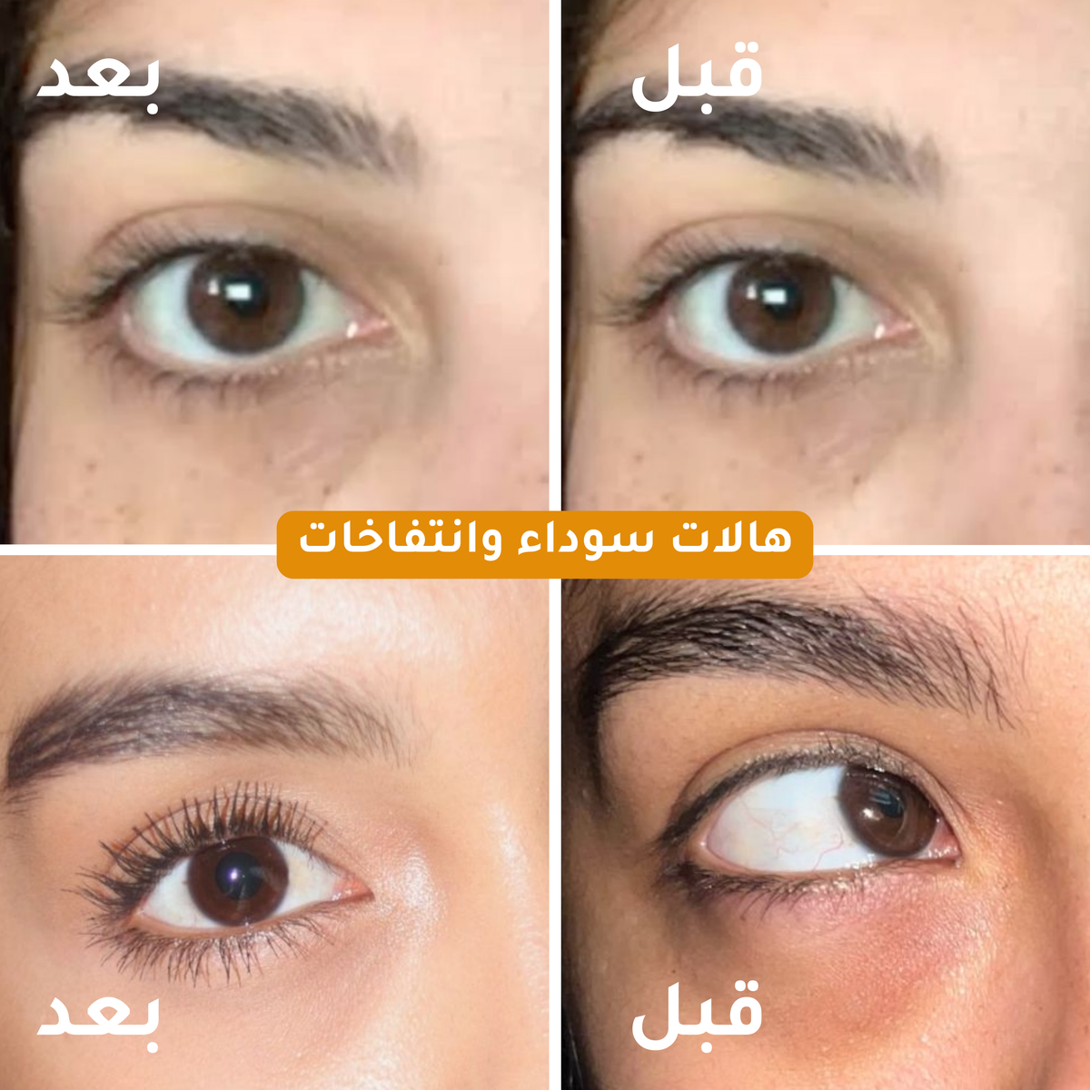Eye Cream - كريم العيون