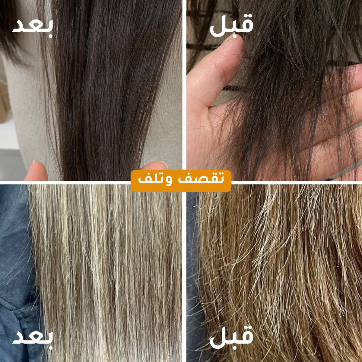 Hair Therapy - معالج الشعر